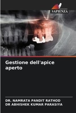 Gestione dell'apice aperto - RATHOD, DR. NAMRATA PANDIT;PARASIYA, DR ABHISHEK KUMAR