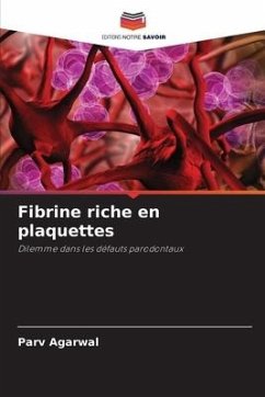 Fibrine riche en plaquettes - Agarwal, Parv