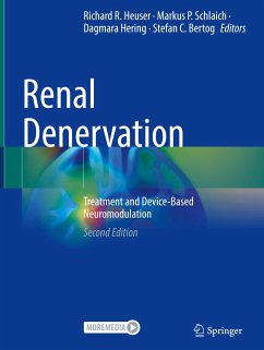 Renal Denervation