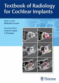 Textbook of Radiology for Cochlear Implants (eBook, ePUB)