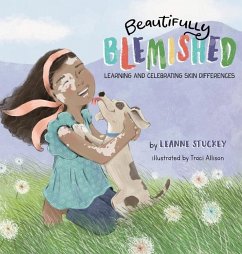 Beautifully Blemished: Learning and Celebrating Skin Differences - Stuckey, Leanne