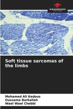 Soft tissue sarcomas of the limbs - Kedous, Mohamed Ali;Barkallah, Oussama;Wael Chebbi, Wael