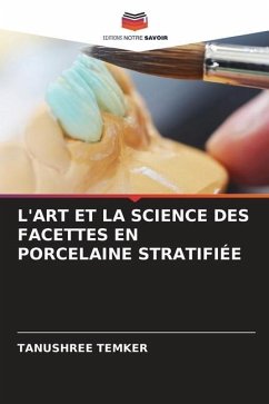 L'ART ET LA SCIENCE DES FACETTES EN PORCELAINE STRATIFIÉE - Temker, Tanushree