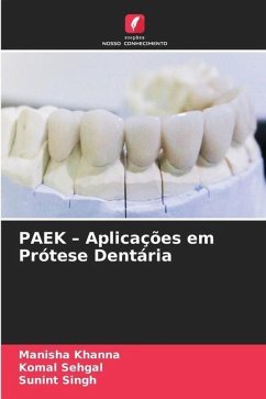 PAEK ¿ Aplicações em Prótese Dentária - Khanna, Manisha;Sehgal, Komal;Singh, Sunint