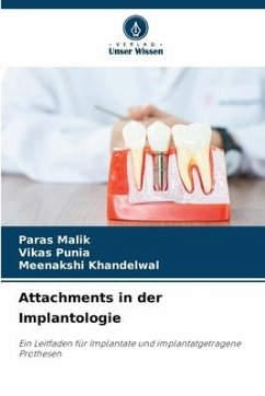 Attachments in der Implantologie - Malik, Paras;Punia, Vikas;Khandelwal, Meenakshi