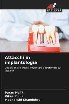 Attacchi in implantologia - Malik, Paras;Punia, Vikas;Khandelwal, Meenakshi