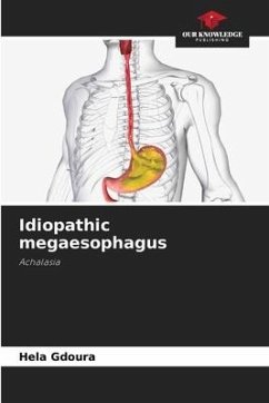 Idiopathic megaesophagus - Gdoura, Hela