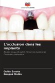 L'occlusion dans les implants