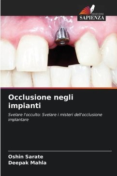 Occlusione negli impianti - SARATE, OSHIN;MAHLA, DEEPAK