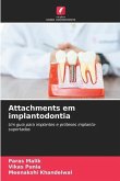 Attachments em implantodontia