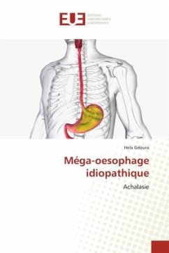 Méga-oesophage idiopathique - Gdoura, Hela