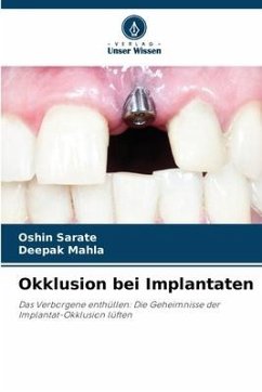 Okklusion bei Implantaten - SARATE, OSHIN;MAHLA, DEEPAK