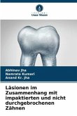 Läsionen im Zusammenhang mit impaktierten und nicht durchgebrochenen Zähnen