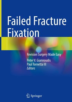 Failed Fracture Fixation