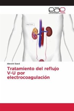 Tratamiento del reflujo V-U por electrocoagulación - Saed, Idweini