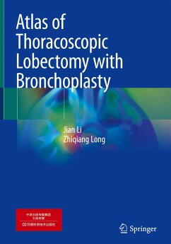 Atlas of Thoracoscopic Lobectomy with Bronchoplasty - Li, Jian;Long, Zhiqiang