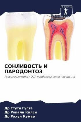 SONLIVOST' I PARODONTOZ SONLIVOST' I PARODONTOZ