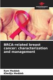 BRCA-related breast cancer: characterization and management