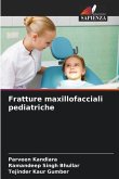 Fratture maxillofacciali pediatriche