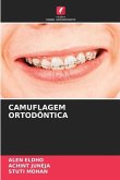 CAMUFLAGEM ORTODÔNTICA