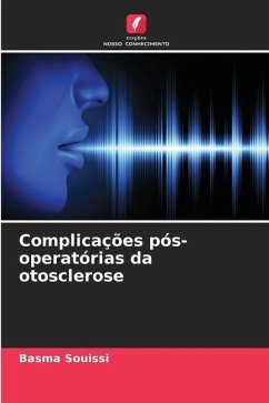 Complicações pós-operatórias da otosclerose - Souissi, Basma