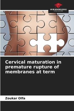 Cervical maturation in premature rupture of membranes at term - Olfa, Zoukar