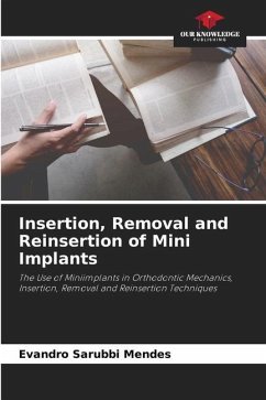 Insertion, Removal and Reinsertion of Mini Implants - Sarubbi Mendes, Evandro