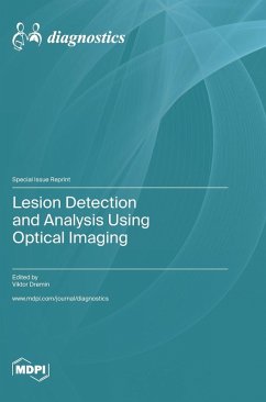 Cover Lesion Detection and Analysis Using Optical Imaging