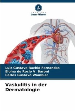 Vaskulitis in der Dermatologie - Rachid Fernandes, Luiz Gustavo;Baroni, Eloina do Rocio V.;Wambier, Carlos Gustavo