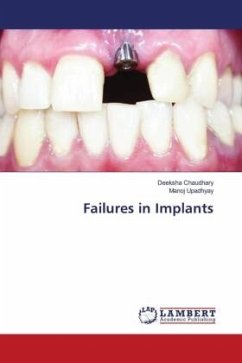 Failures in Implants - Chaudhary, Deeksha;Upadhyay, Manoj