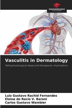 Vasculitis in Dermatology - Rachid Fernandes, Luiz Gustavo;Baroni, Eloina do Rocio V.;Wambier, Carlos Gustavo