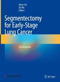Segmentectomy for Early-Stage Lung Cancer (eBook, PDF)