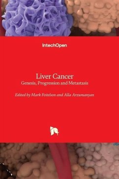 Liver Cancer - Genesis, Progression and Metastasis