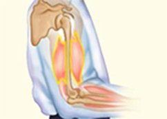 Effect of Load on SMT (Free & After Load) (eBook, ePUB) - Bajaj, S K