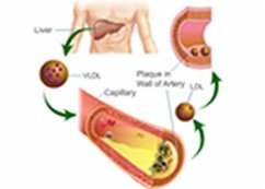 Estimation of Blood LDL Cholesterol and VLDL Cholesterol (eBook, ePUB) - Shah, Seema
