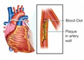Estimation of Blood Triglycerides (eBook, ePUB) Estimation of Blood Triglycerides (eBook, ePUB)