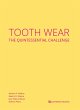 Tooth Wear (eBook, ePUB) - Bild 1