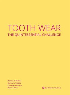 Tooth Wear (eBook, ePUB) - Vilaboa, Débora R.; Vilaboa, Beatriz R.; Reuss, Jose Manuel; Reuss, Débora