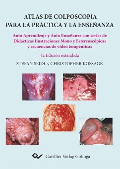 Atlas de colposcopia para la práctica y la enseñanza (eBook, PDF)