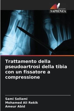 Trattamento della pseudoartrosi della tibia con un fissatore a compressione - Sellami, Sami;Rekik, Mohamed Ali;Abid, Ameur