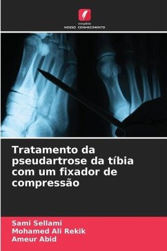 Tratamento da pseudartrose da tíbia com um fixador de compressão - Sellami, Sami;Rekik, Mohamed Ali;Abid, Ameur