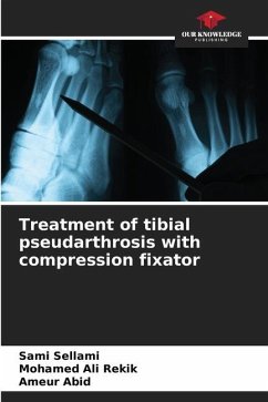 Treatment of tibial pseudarthrosis with compression fixator - Sellami, Sami;Ali Rekik, Mohamed;Abid, Ameur