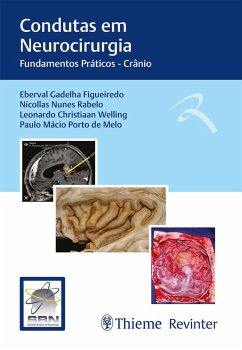 Condutas em Neurocirurgia (eBook, ePUB) - Gadelha Figueiredo, Eberval; Nunes Rabelo, Nícollas; Christian Welling, Leonardo