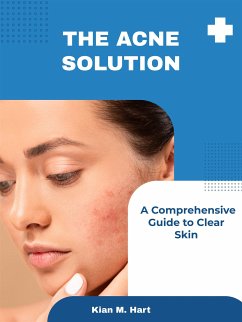 The Acne Solution (eBook, ePUB) - M. Hart, Kian