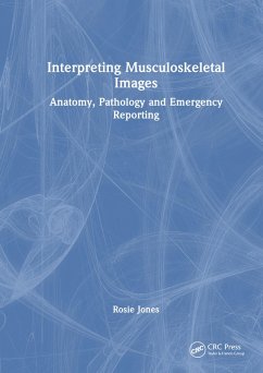 Interpreting Musculoskeletal Images (eBook, ePUB) - Jones, Rosie