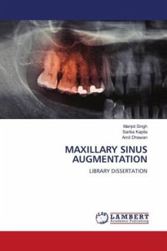 MAXILLARY SINUS AUGMENTATION - Singh, Manjot;Kapila, Sarika;Dhawan, Amit