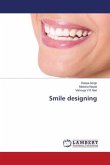 Smile designing
