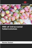 MRI of intracranial tuberculomas