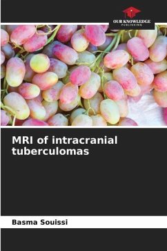 MRI of intracranial tuberculomas - Souissi, Basma