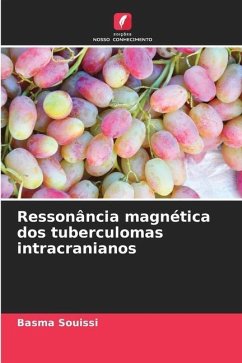 Ressonância magnética dos tuberculomas intracranianos - Souissi, Basma